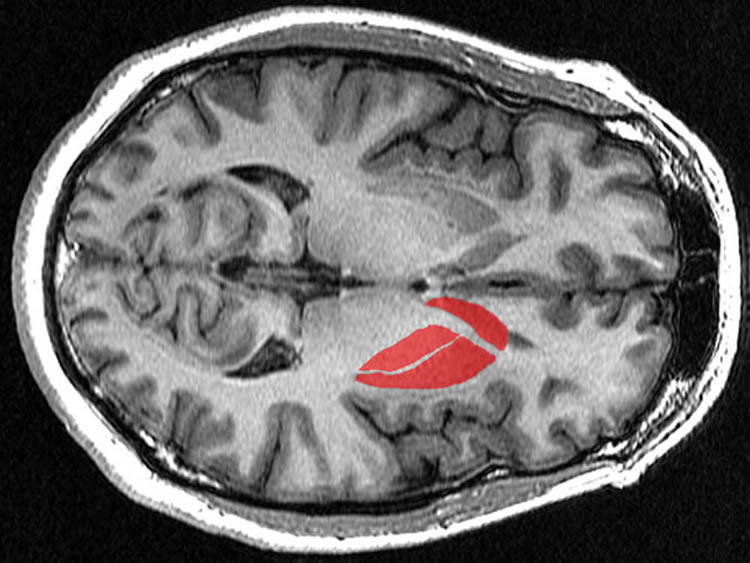 the location of the striatum
