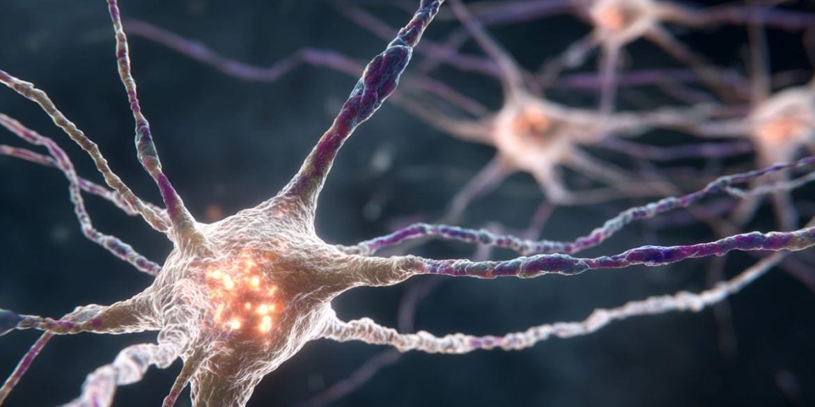 This shows a neuron.