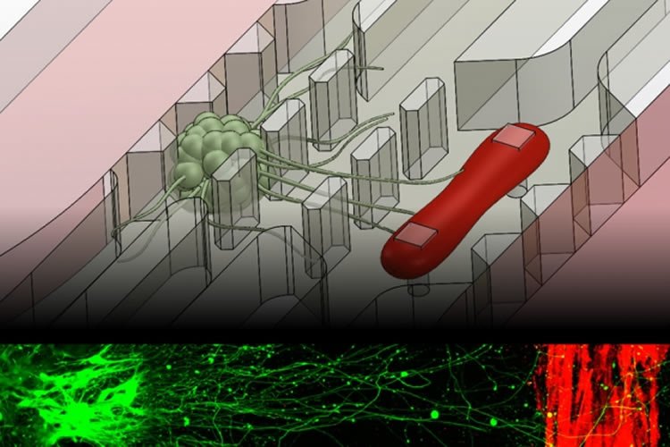 Image shows the microchip and neurons.