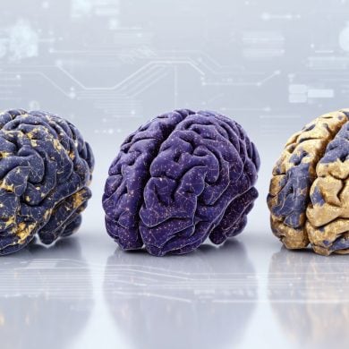 This shows three brains.