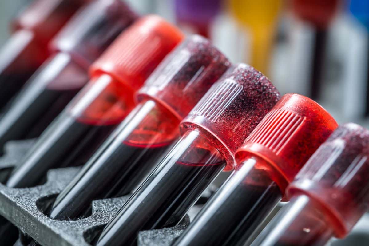 This shows blood vials.