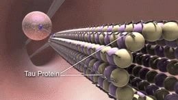 The image shows microtubule disintegration in alzheimer's disease.