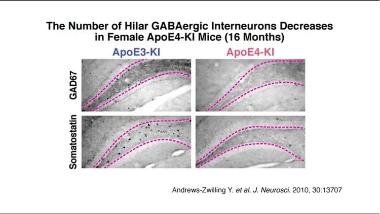 Image shows brain slices.
