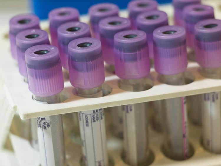 Image shows blood test tubes.