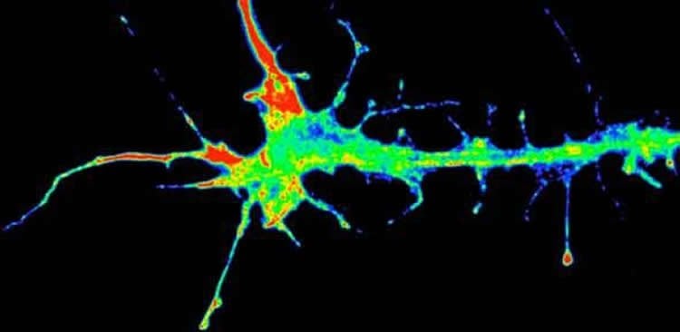 Image shows an axon and neuron.