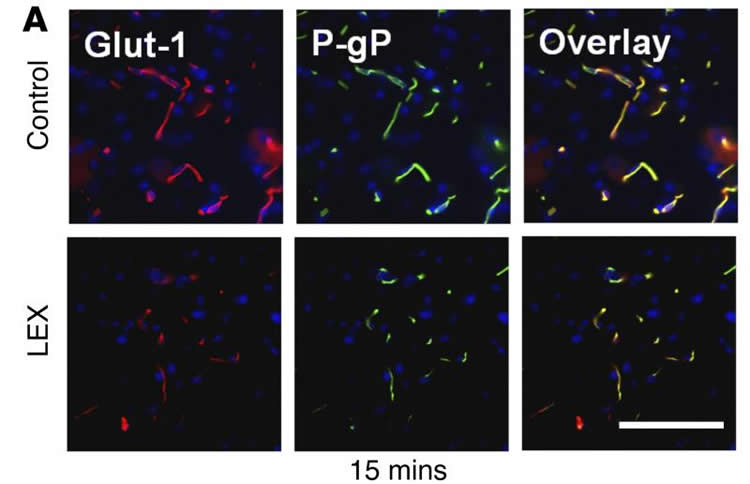 Image shows brain sliced from the experiment.