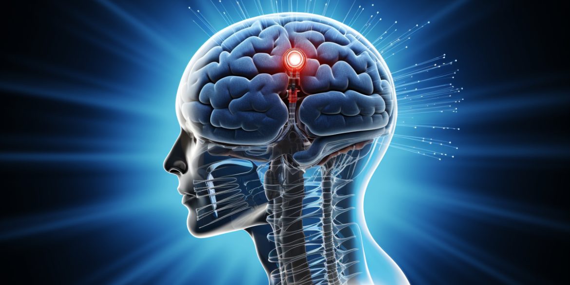 This shows a brain and an implant.