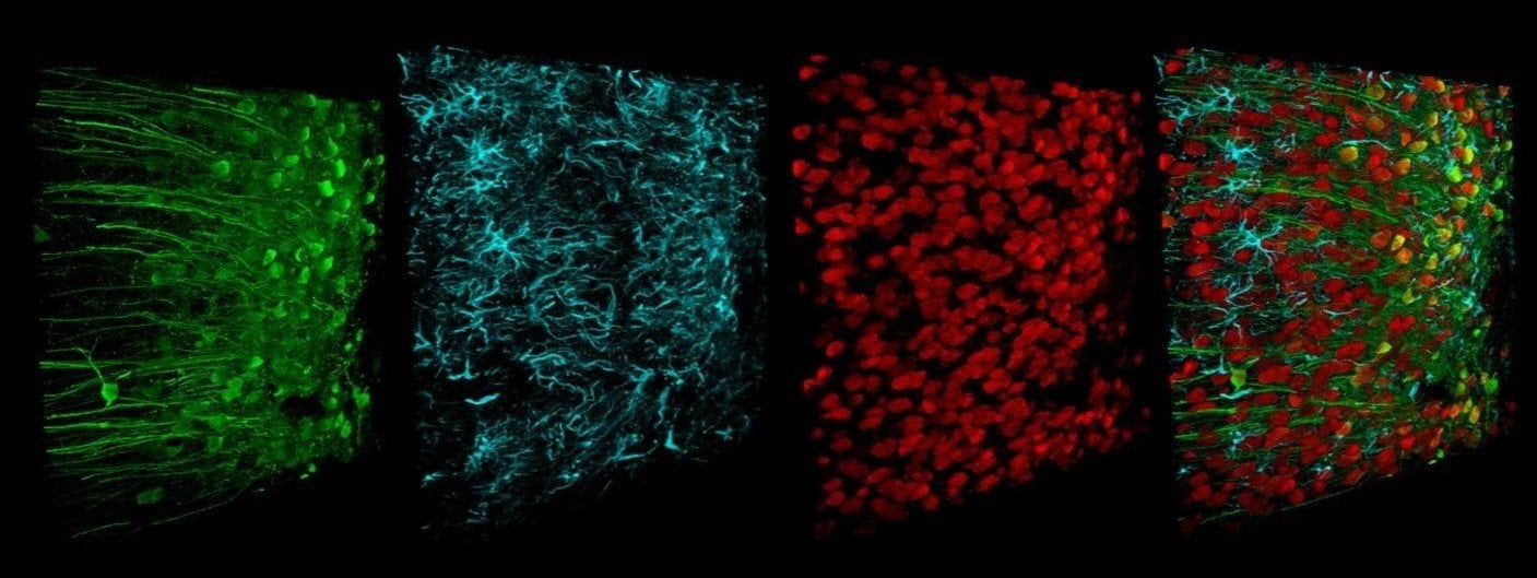 University of Bristol neuroscience festival image.