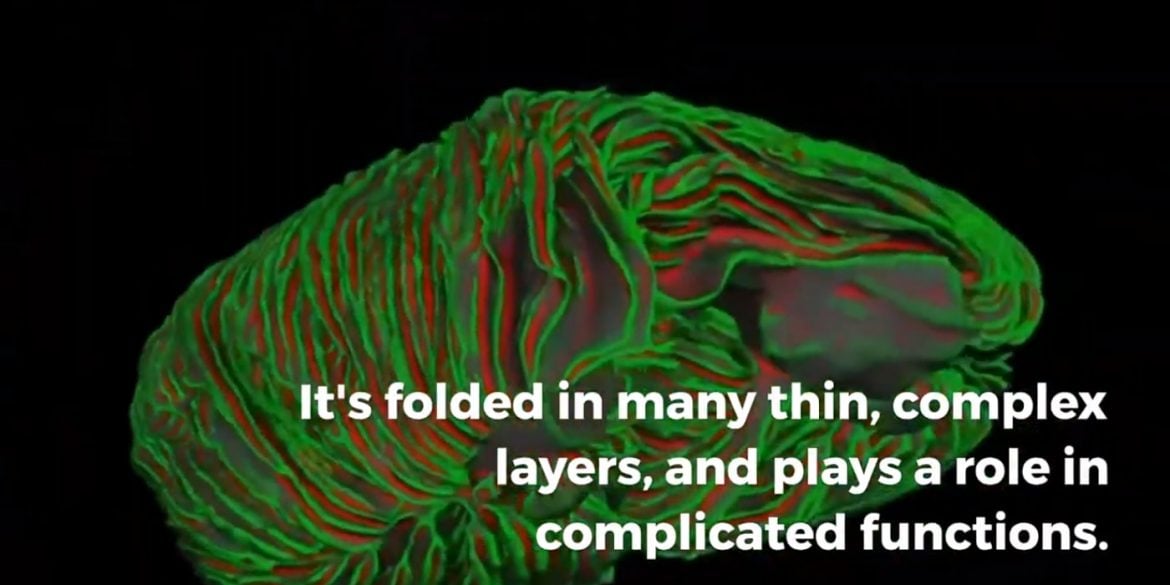 This shows the cerebellum