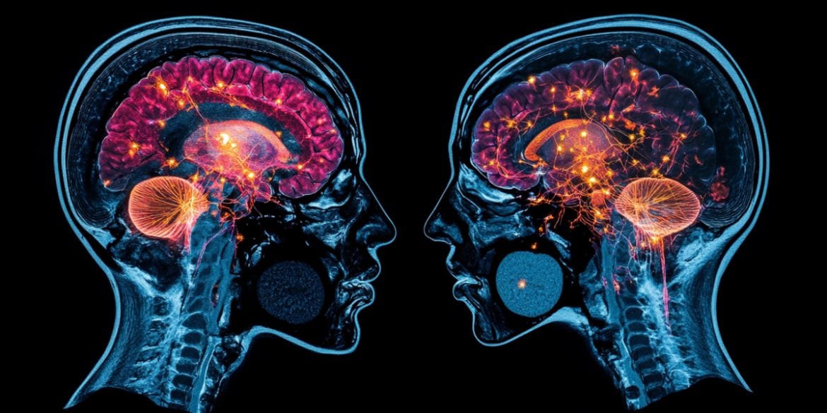 This shows two heads and brains.