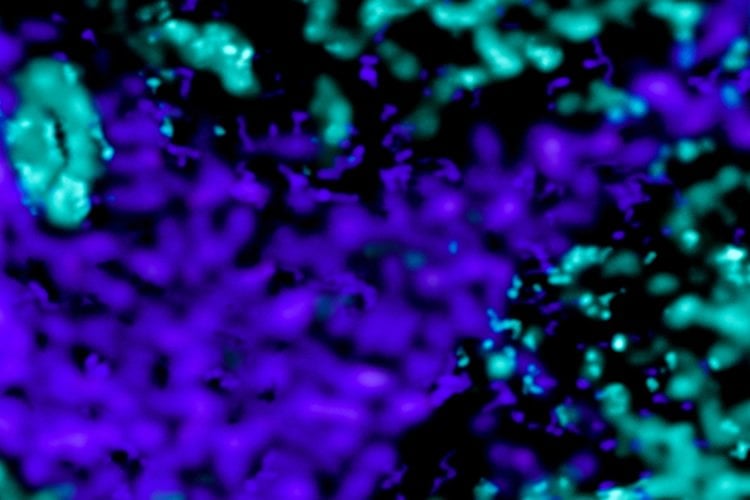 The image shows the dopamine and iron distribution in the mouse brain.