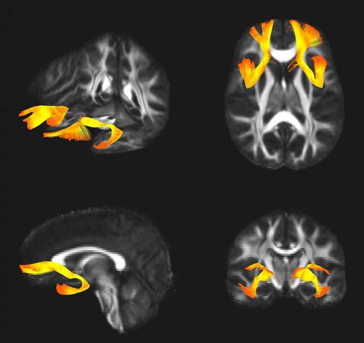 Image shows brain scans.