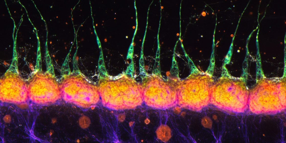 This shows AI representations of neurons.