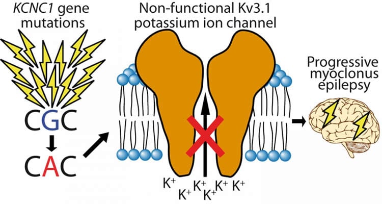 This image is a diagram showing the flow from the mutation to epileptic output.