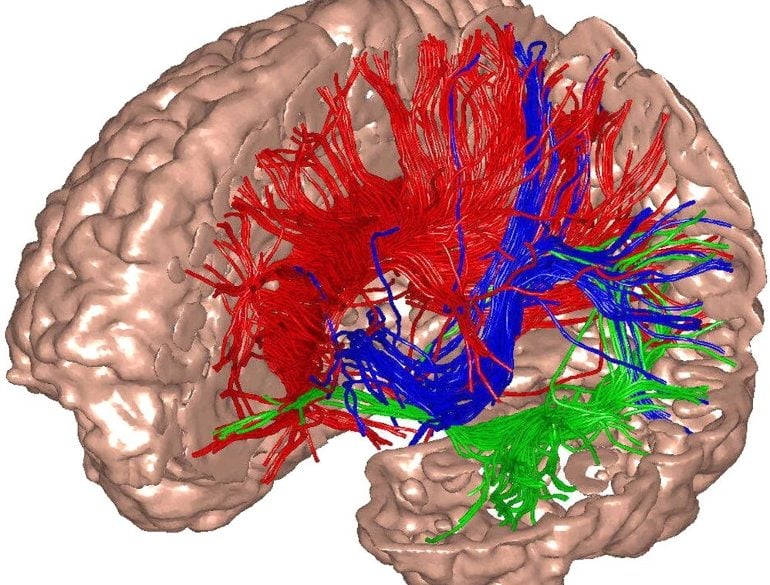 This shows a diagram of a brain