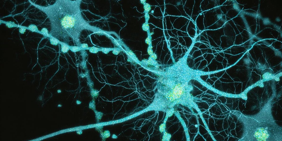 This shows hippocampal neurons, and is an AI representation.