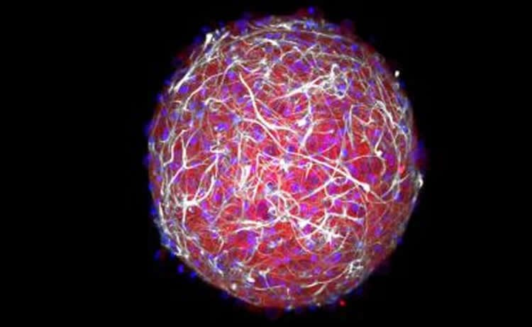 Image shows a bundle of neurons in the mini brain. The mini brain is bright pink and the neurons are purple and white.