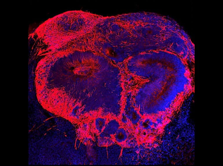 This shows the mini brain