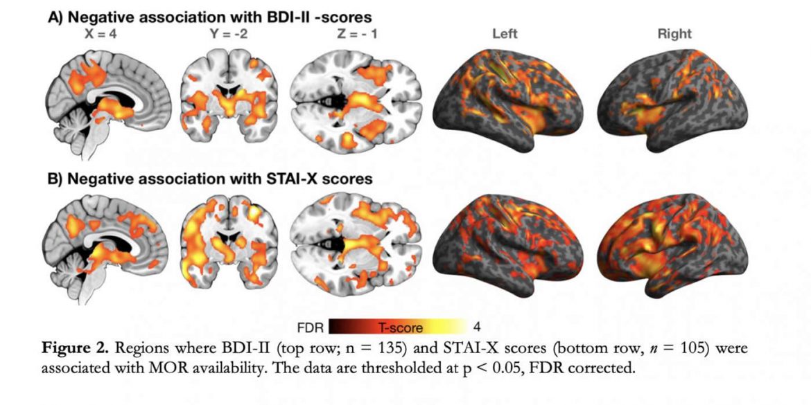 This shows brain scans from the study