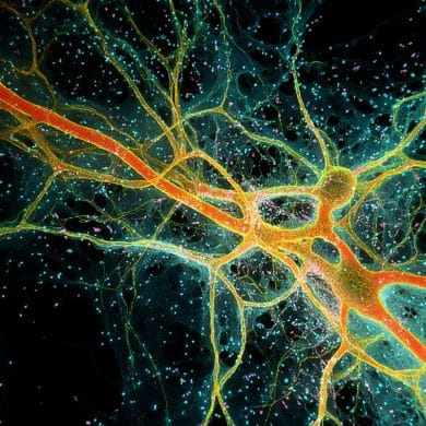 This shows neurons.