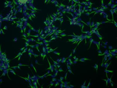 The image shows neural stem cells derived from people with bipolar disorder.