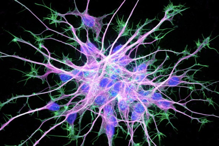 This shows a neuron
