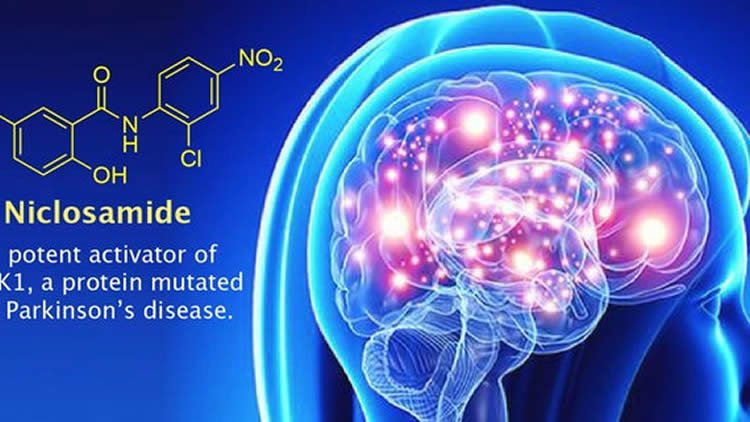 Image shows a brain.