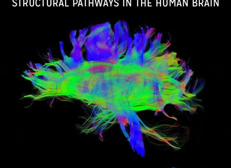 This shows a brain scan from the study