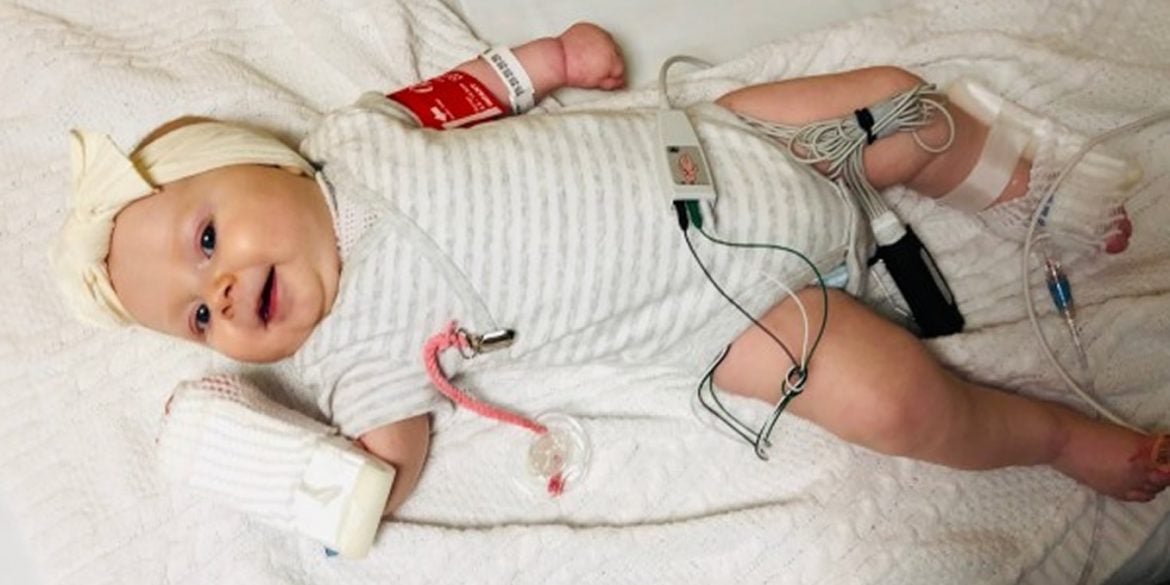 This shows baby Arabella Smygov following gene therapy treatment for SMA