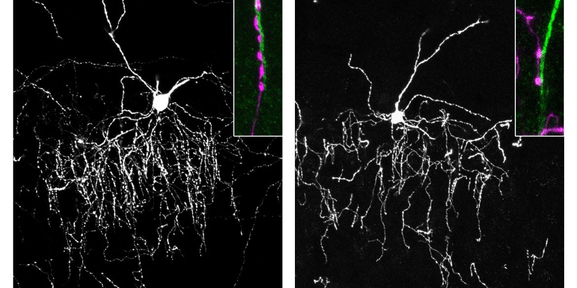 Illustration of chandelier cells connecting to pyramidal neurons in the brain.