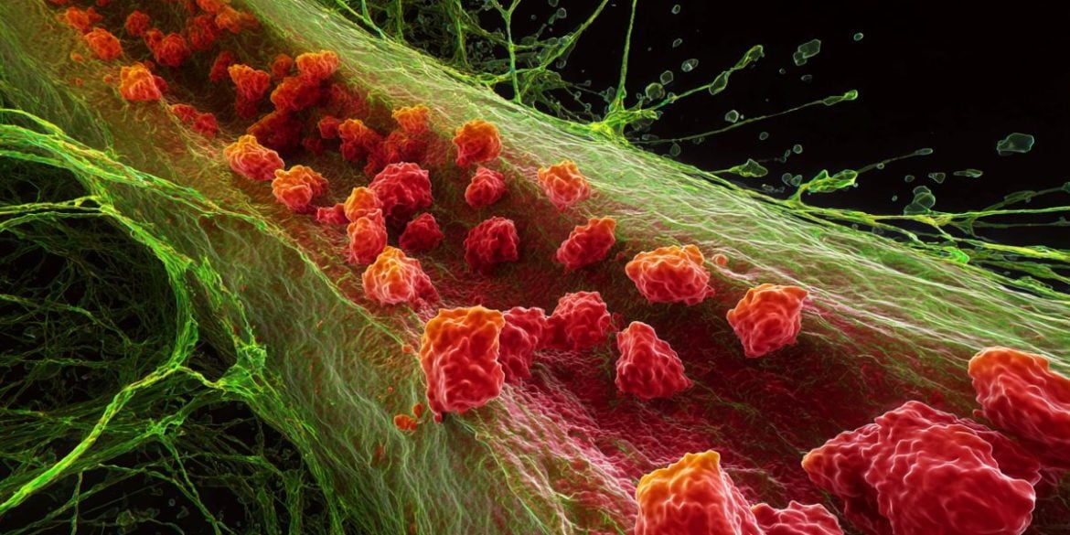 This image represents the Tau clearing process.