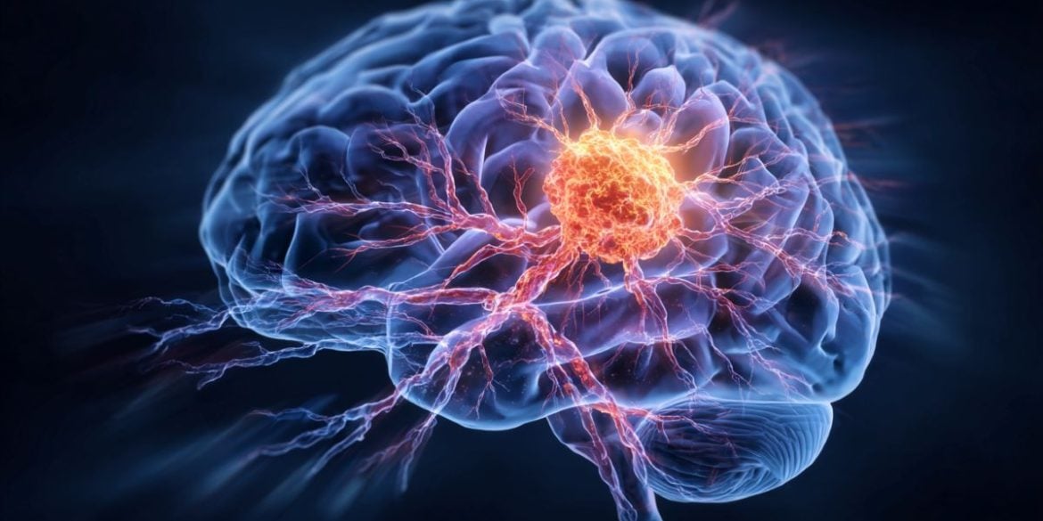 This shows a brain with an overlay of cancer cells.