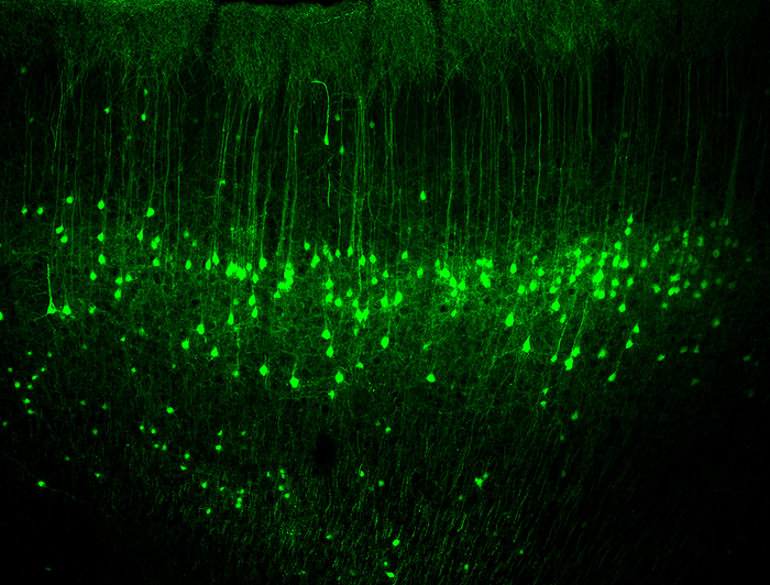 This shows neurons in the motor cortex